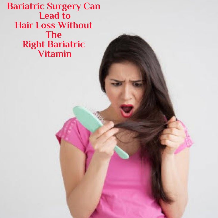 Hair Loss After Gastric Sleeve
